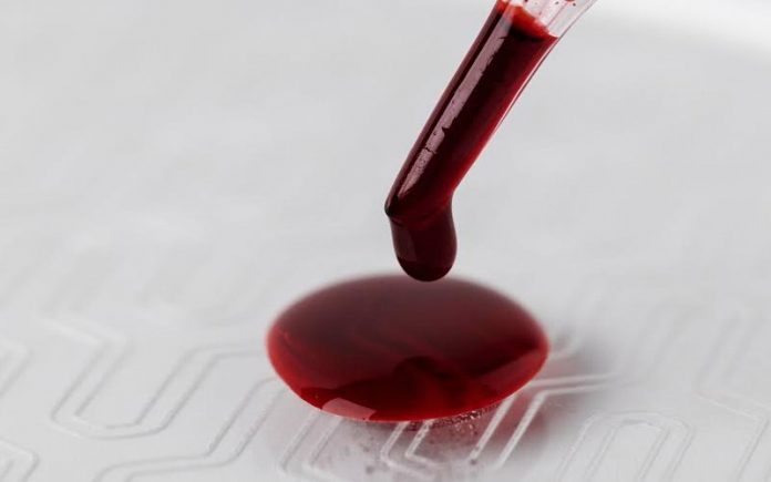 New blood test may be able to predict Alzheimer’s