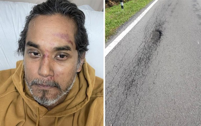 Khairy cedera ringan terjatuh ketika berbasikal
