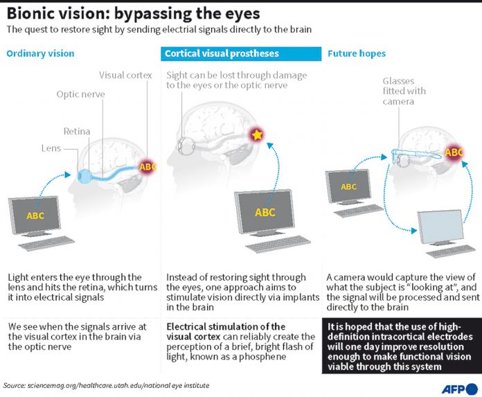 Vision-restoring brain implants spell breakthrough