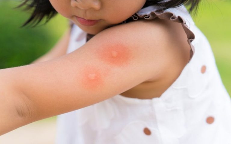 How to keep your child safe from dengue