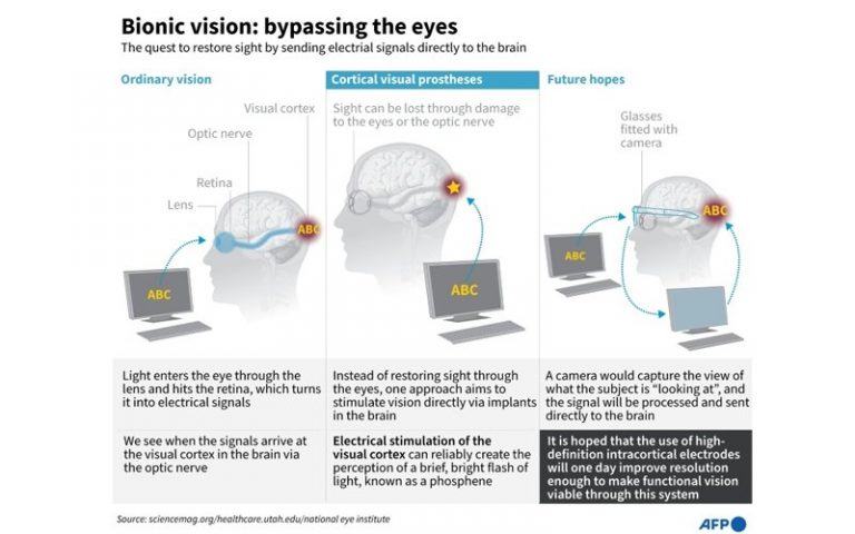 Blind may see again with brain implants that restore vision