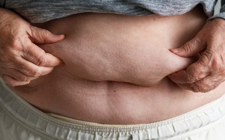 Britain to ban ‘buy 1 free 1’ promotions to fight obesity