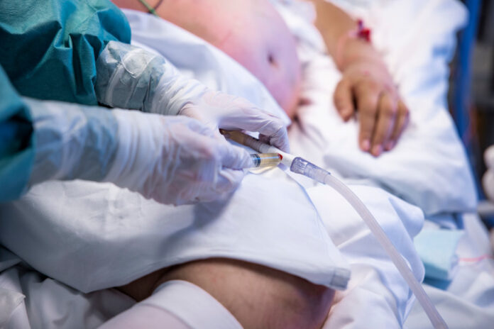 Iceland's first Omicron case reported in man who had not travelled