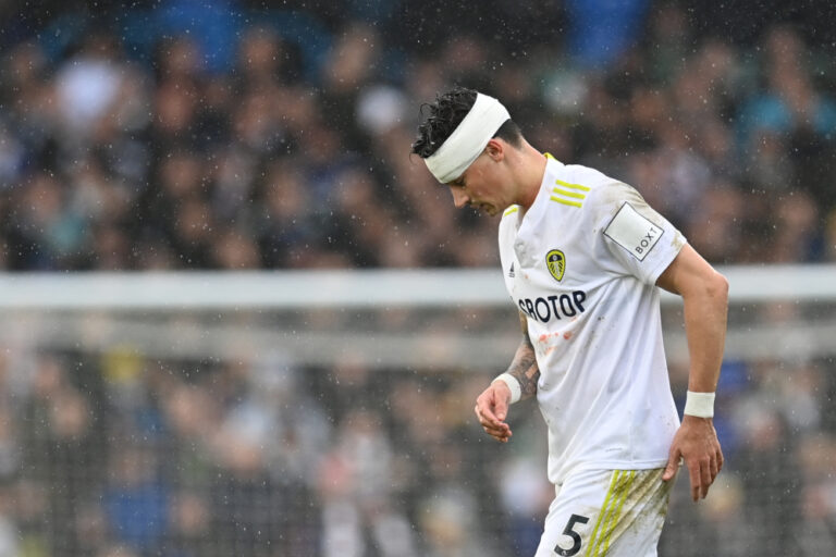 No need to dramatise response to Koch head injury, says Bielsa